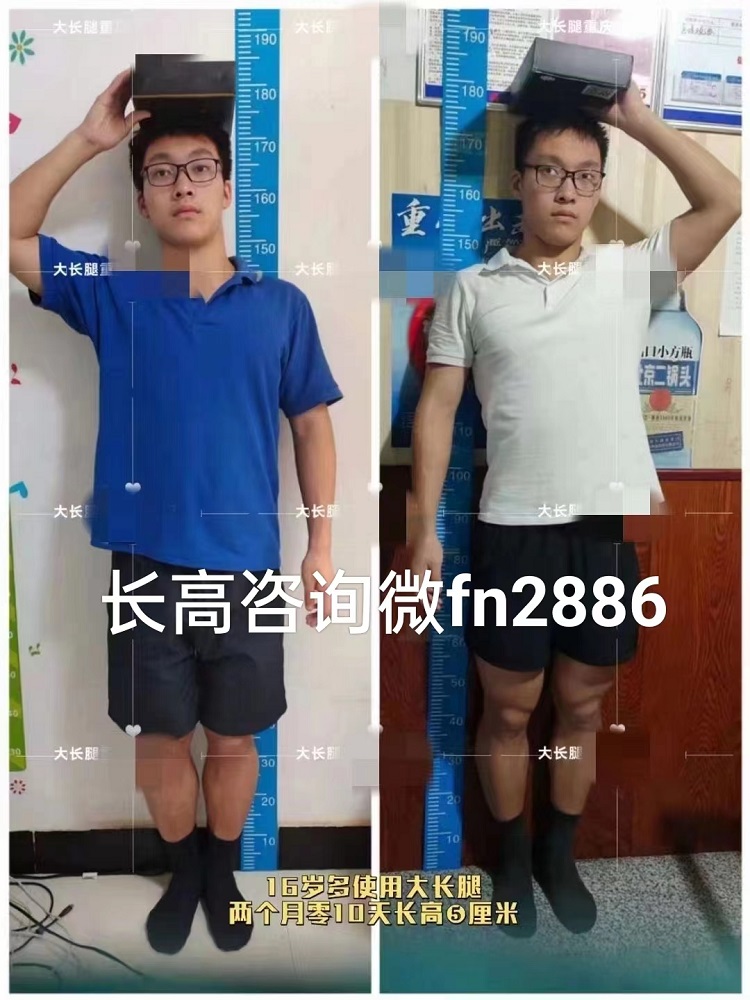 17歲怎么長高 18歲怎么長高 20歲怎么長高